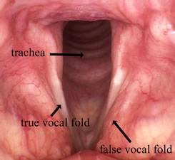 HPV - Papillomas of the Larynx